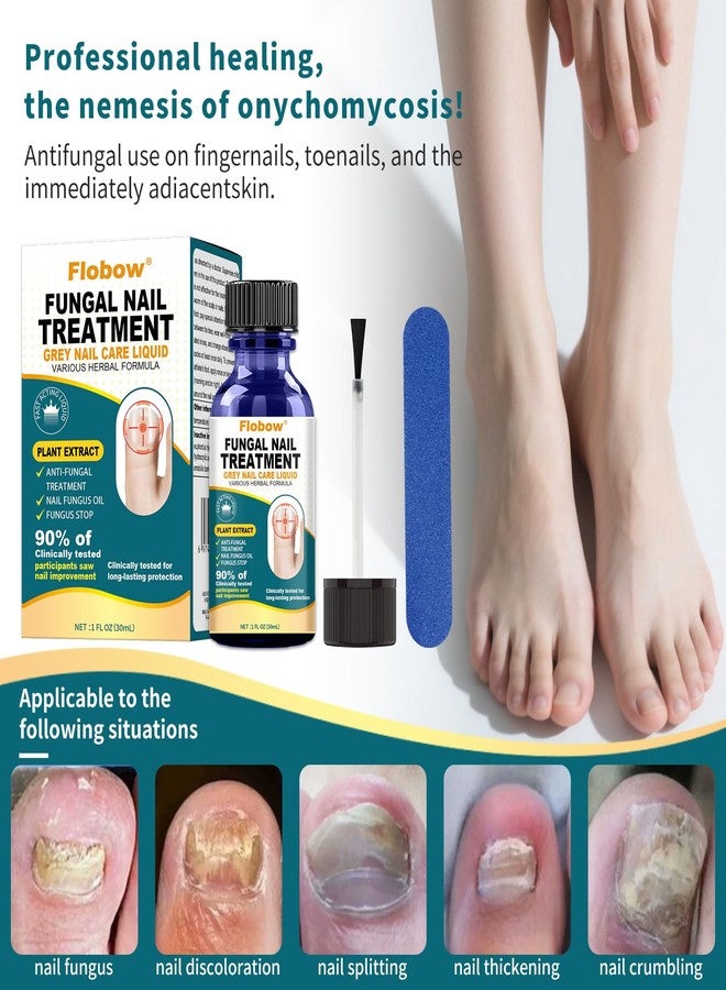 Flobow Toenail Fungus Treatment Extra Strength nail fungus treatment for fingernails, Yellow, Discolored, Broken and Ingrown Nails, ingrown nails and foot fungus treatment extra strength（30ML） - Image 3